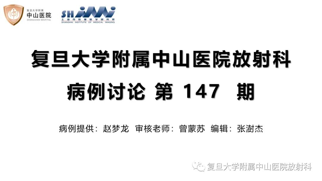 【病例】内淋巴积水(梅尼埃病)一例MR影像-1