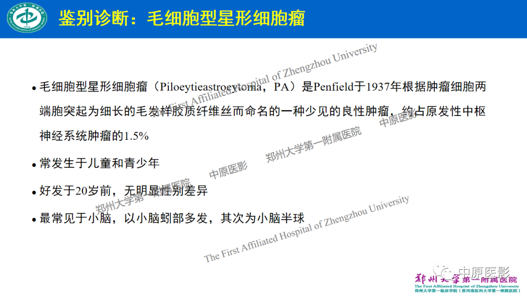 【病例】枕骨大孔区脉络丛乳头状瘤1例MR影像-14