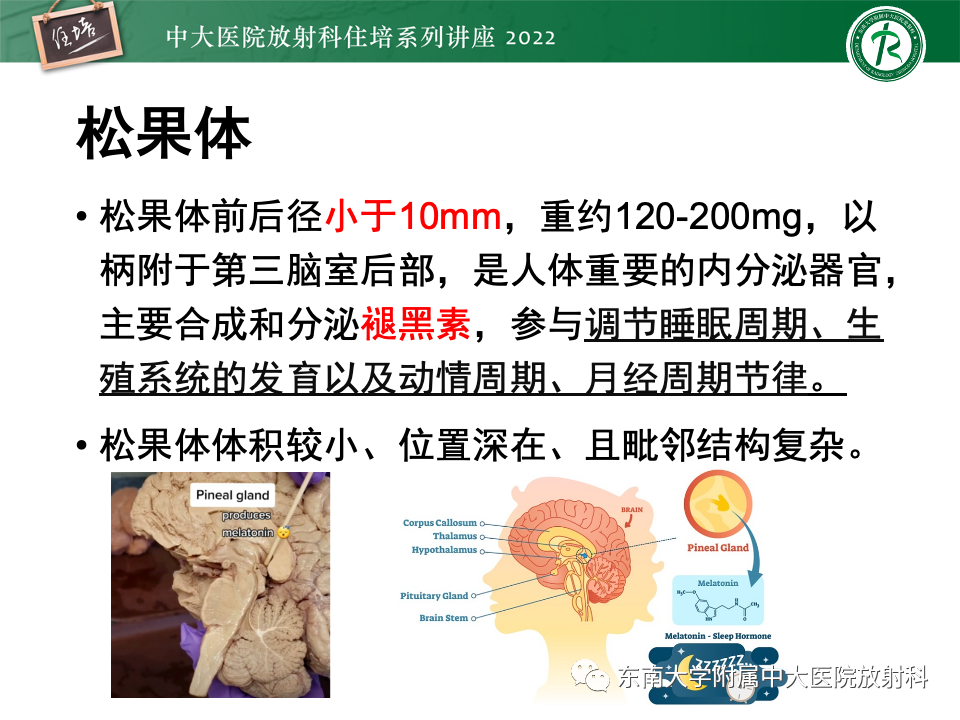 【PPT】松果体区占位性病变的诊断思路-2