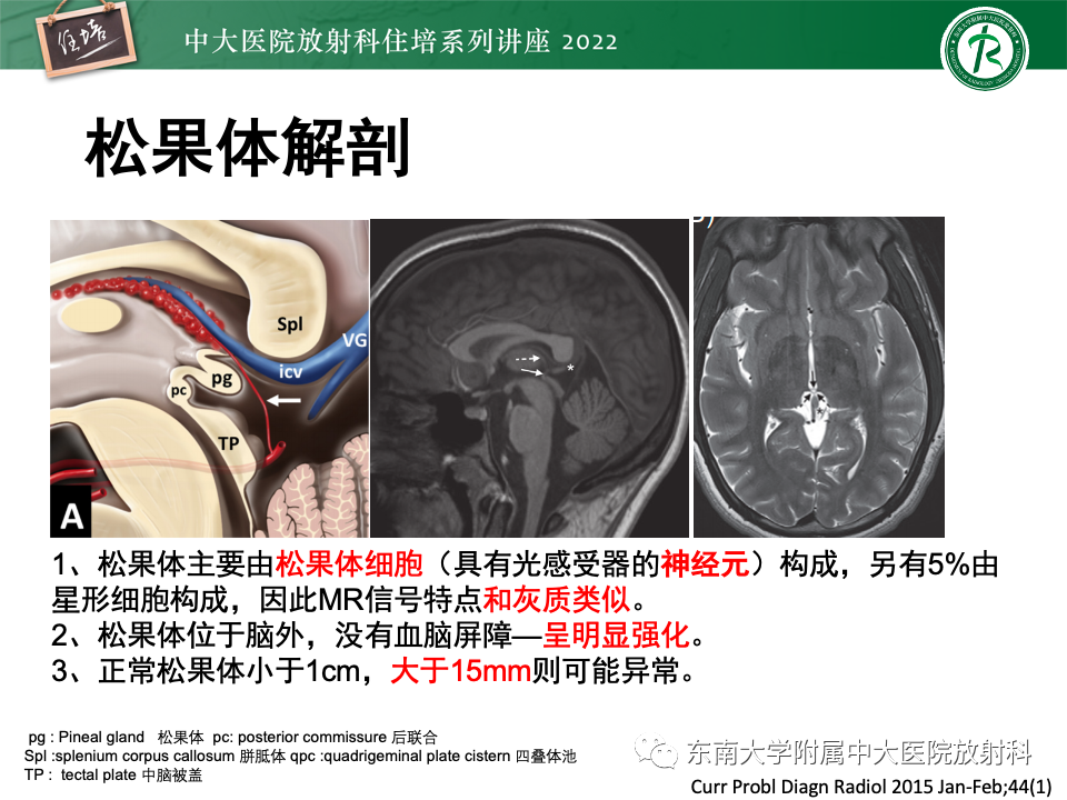 【PPT】松果体区占位性病变的诊断思路-3