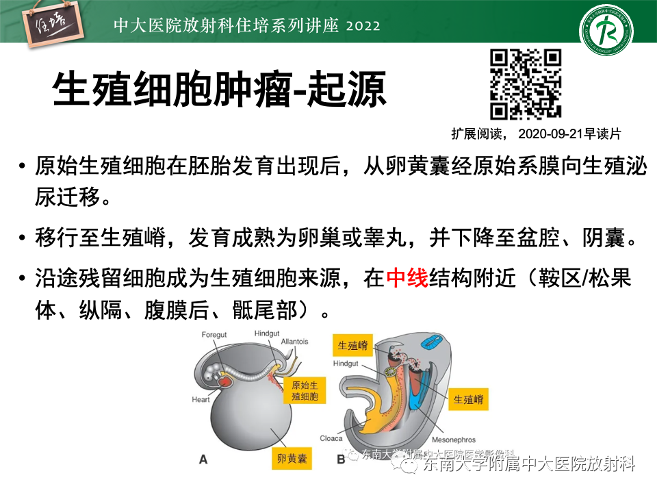 【PPT】松果体区占位性病变的诊断思路-13