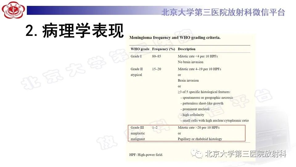 【PPT】间变性脑膜瘤-15