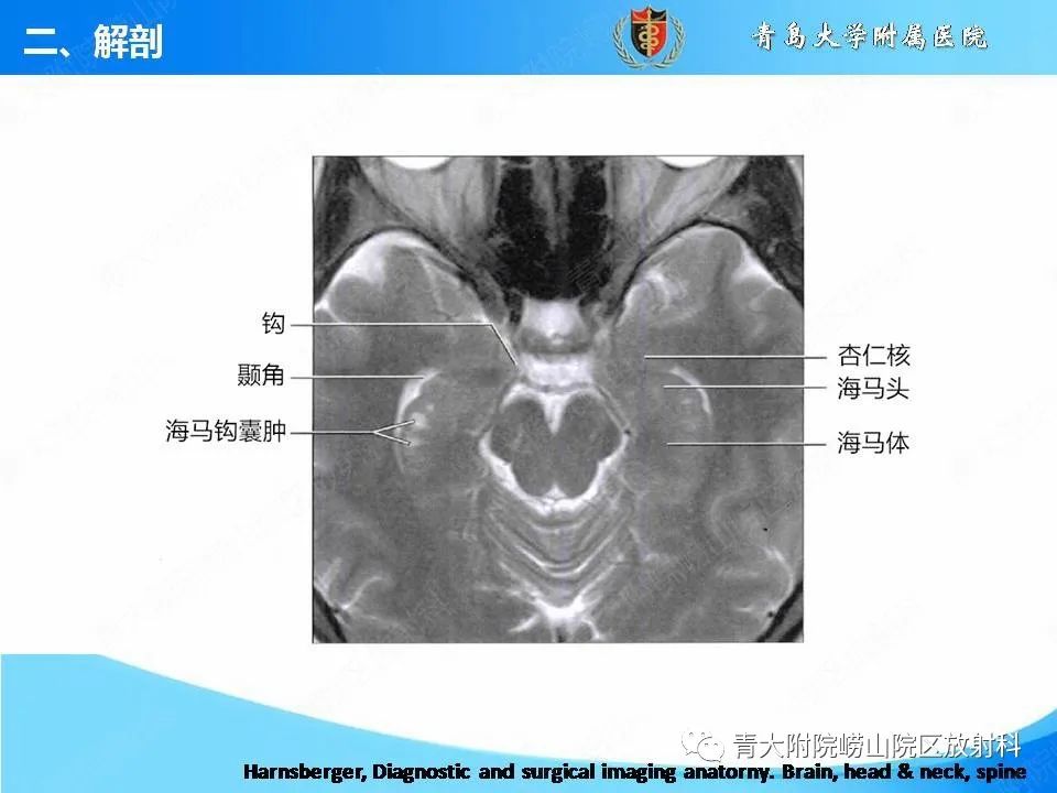 【PPT】自身免疫性脑炎的影像诊断与鉴别-10