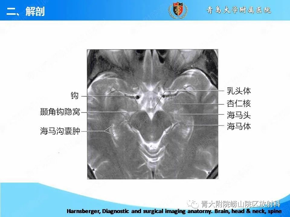 【PPT】自身免疫性脑炎的影像诊断与鉴别-11