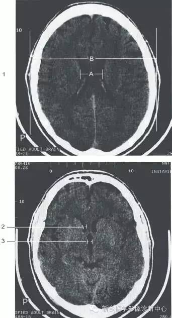 头部正常影像数据