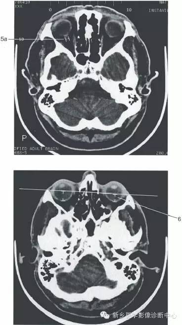 头部正常影像数据