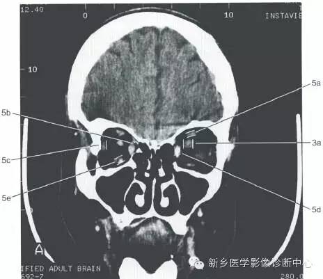 眼眶的正常数据