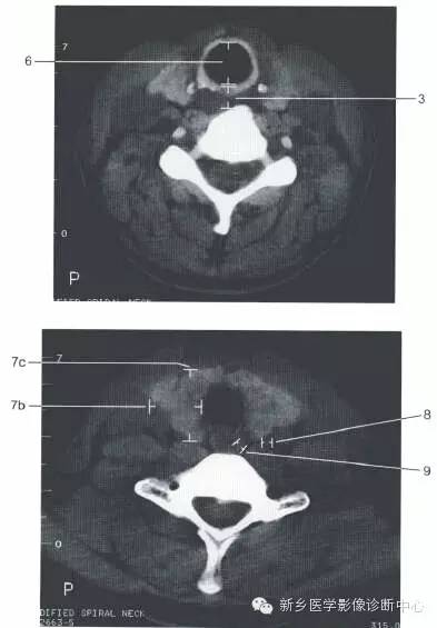 喉部的一些正常数值