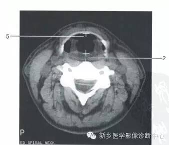 喉部的一些正常数值