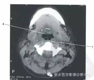 喉部的一些正常数值