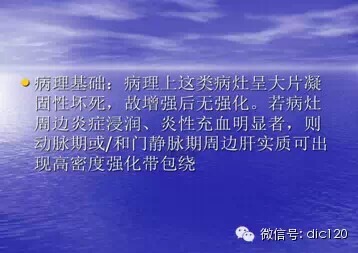 肝脏炎性假瘤的CT诊断