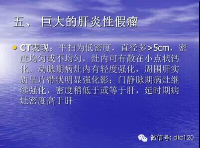 肝脏炎性假瘤的CT诊断