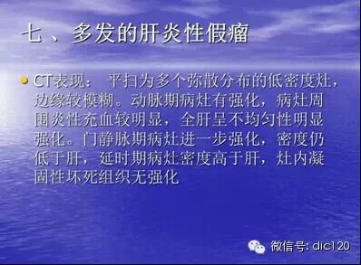 肝脏炎性假瘤的CT诊断