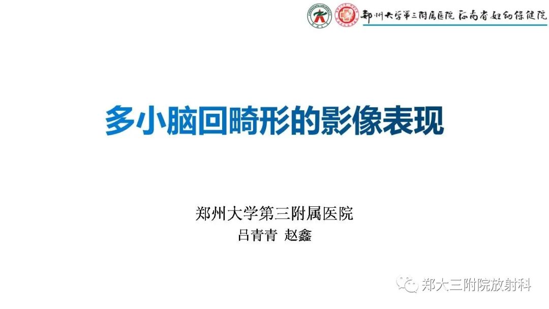 【PPT】多小脑回畸形的影像表现