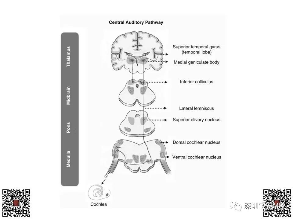 【PPT】感音性听力损失的影像检查-5