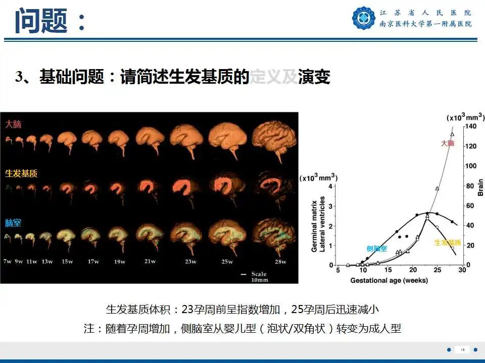 【PPT】生发基质-脑室内出血-16