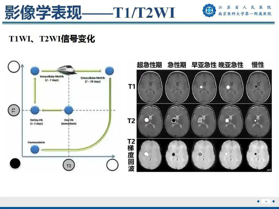 【PPT】生发基质-脑室内出血-23