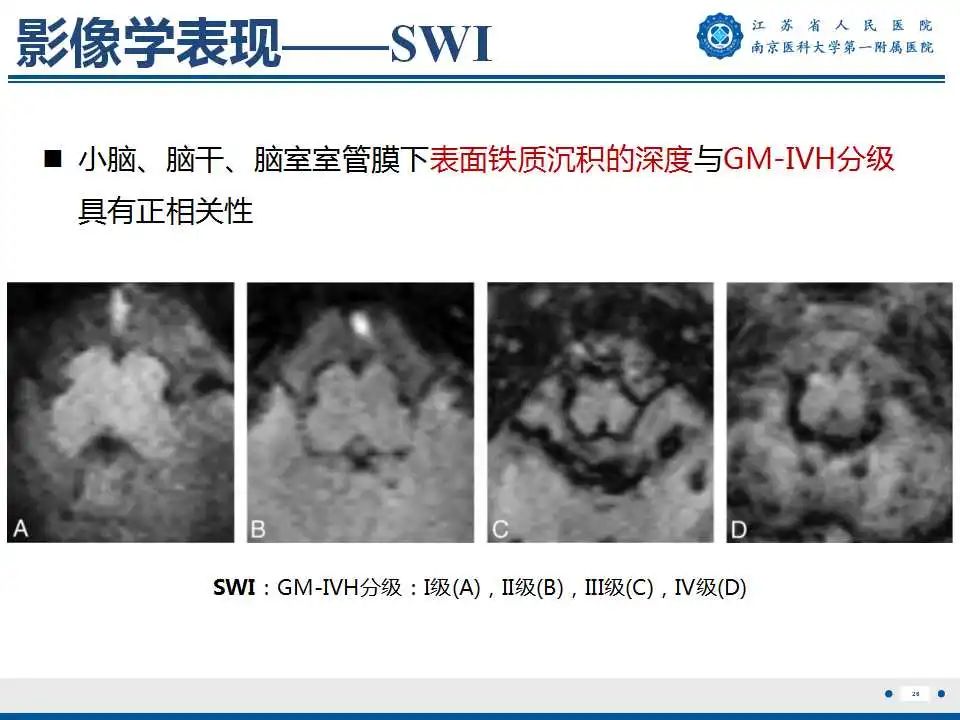 【PPT】生发基质-脑室内出血-27