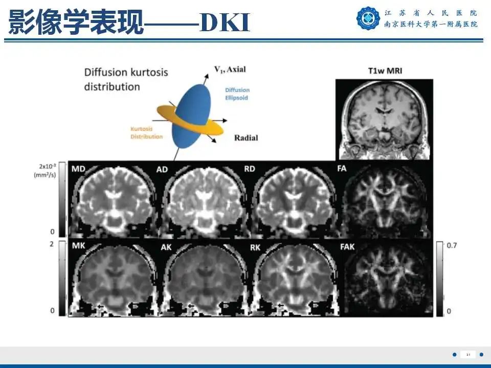 【PPT】生发基质-脑室内出血-32