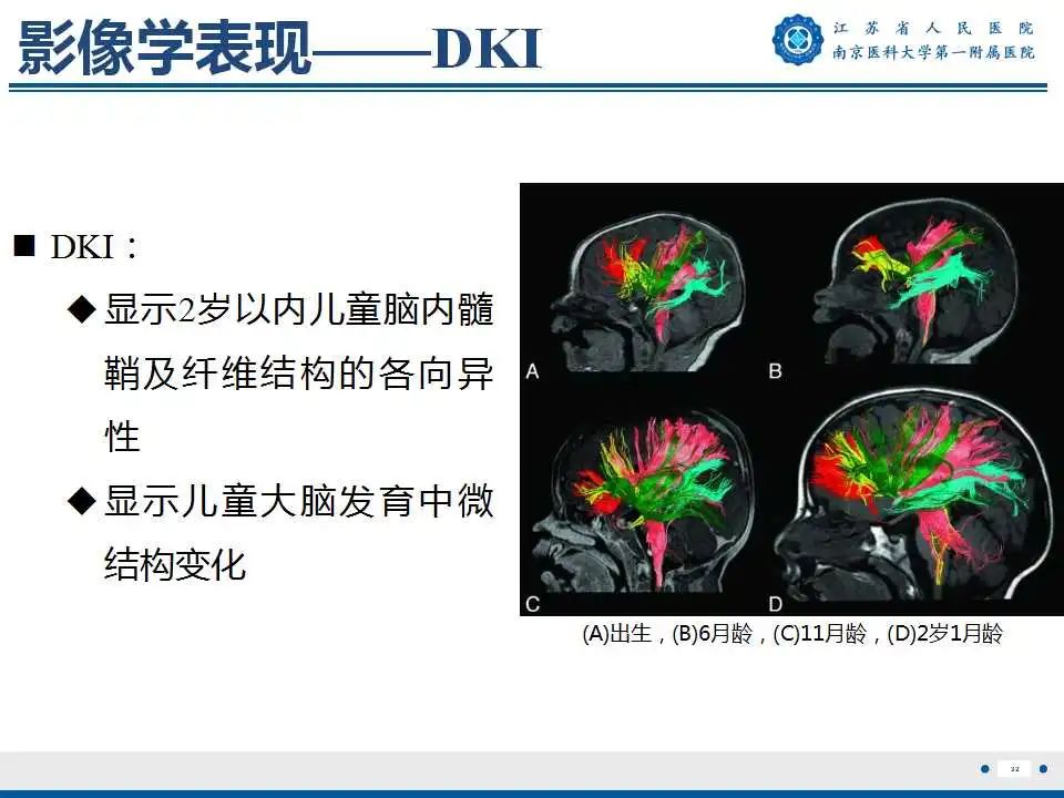 【PPT】生发基质-脑室内出血-33