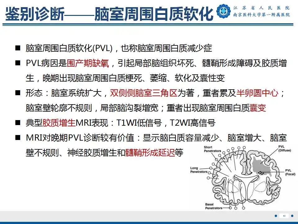 【PPT】生发基质-脑室内出血-41