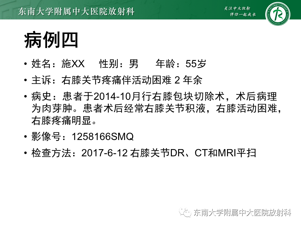 【PPT】膝关节腱鞘巨细胞瘤-25 【PPT】膝关节腱鞘巨细胞瘤-25