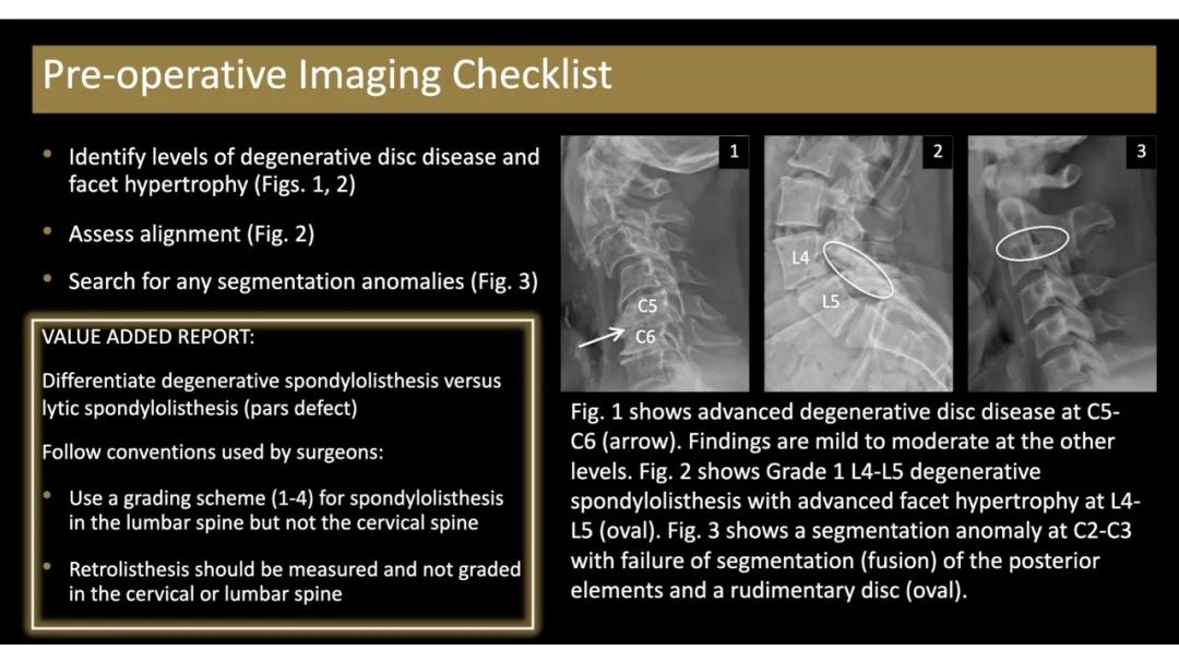 【PPT】评估围手术期脊柱:除了退行性椎间盘疾病和金属植入物的并发症外-8 【PPT】评估围手术期脊柱:除了退行性椎间盘疾病和金属植入物的并发症外-8
