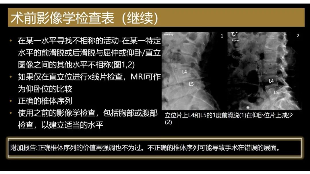 【PPT】评估围手术期脊柱:除了退行性椎间盘疾病和金属植入物的并发症外-9 【PPT】评估围手术期脊柱:除了退行性椎间盘疾病和金属植入物的并发症外-9