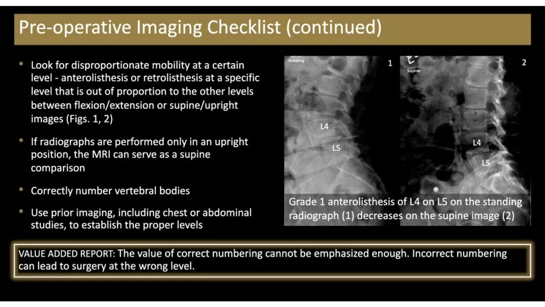 【PPT】评估围手术期脊柱:除了退行性椎间盘疾病和金属植入物的并发症外-10 【PPT】评估围手术期脊柱:除了退行性椎间盘疾病和金属植入物的并发症外-10