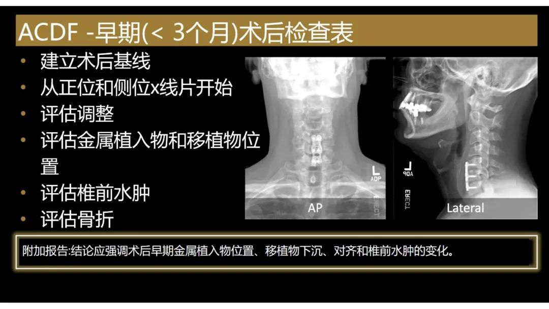 【PPT】评估围手术期脊柱:除了退行性椎间盘疾病和金属植入物的并发症外-19 【PPT】评估围手术期脊柱:除了退行性椎间盘疾病和金属植入物的并发症外-19