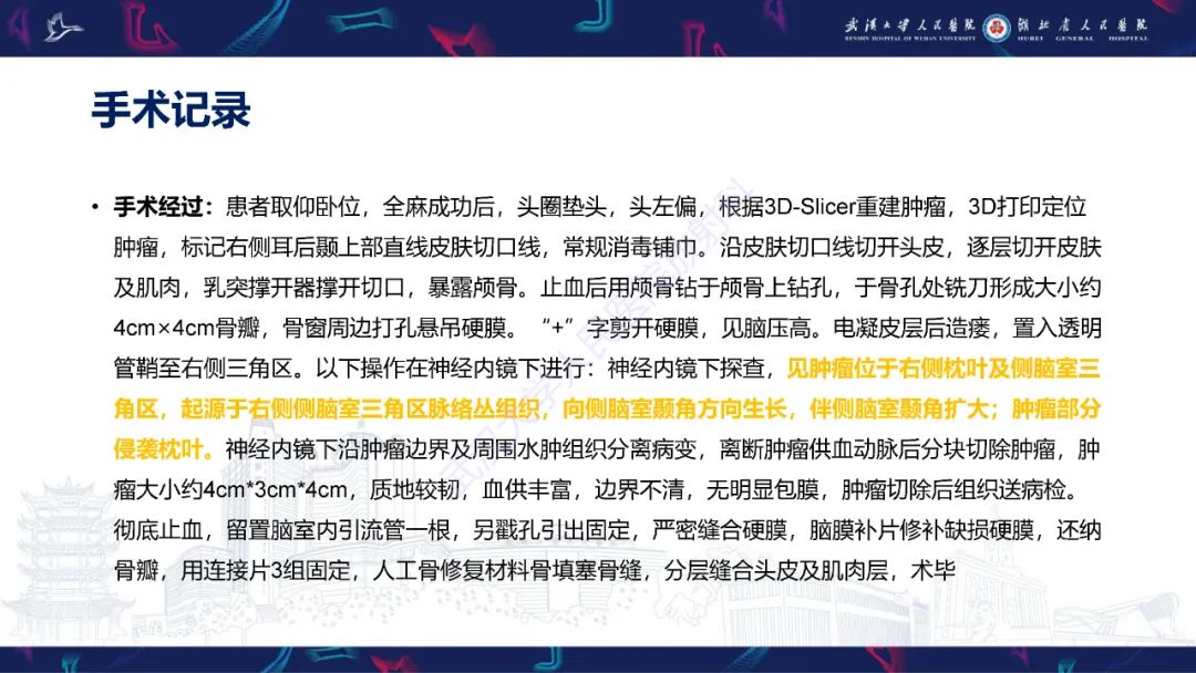 【PPT】侧脑室肿瘤影像诊断-5