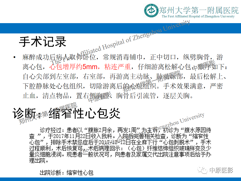 【病例】缩窄性心包炎1例MR影像-9