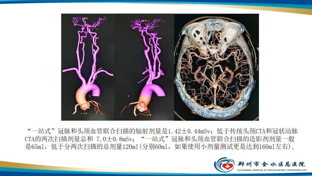 【PPT】冠脉头颈一站式CTA联合扫描技术-4