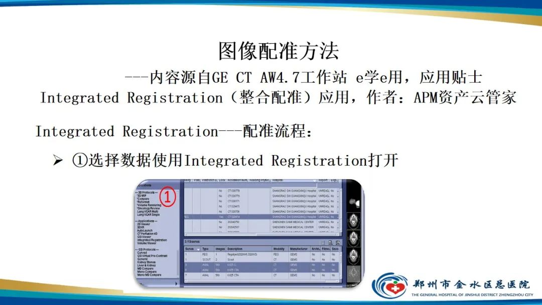 【PPT】冠脉头颈一站式CTA联合扫描技术-31