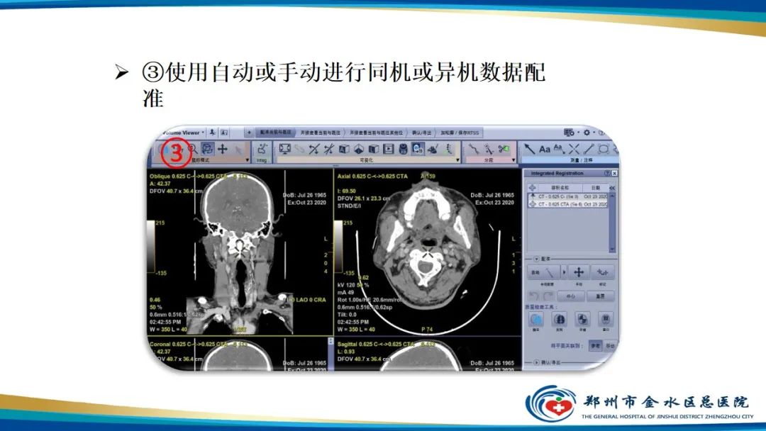 【PPT】冠脉头颈一站式CTA联合扫描技术-33