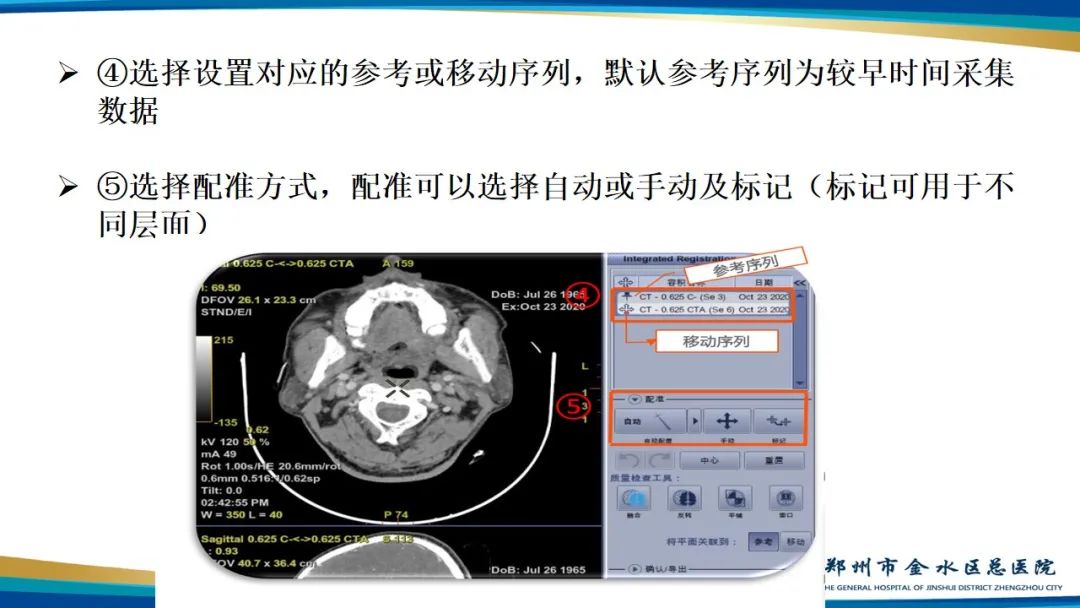 【PPT】冠脉头颈一站式CTA联合扫描技术-34
