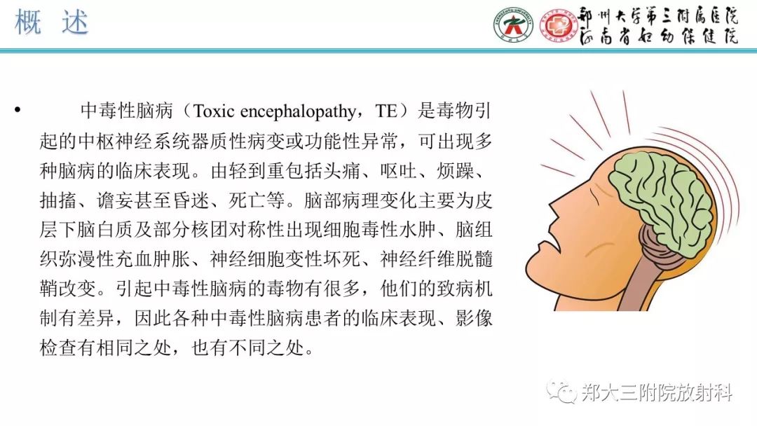 【PPT】中毒性脑病影像学诊断-2