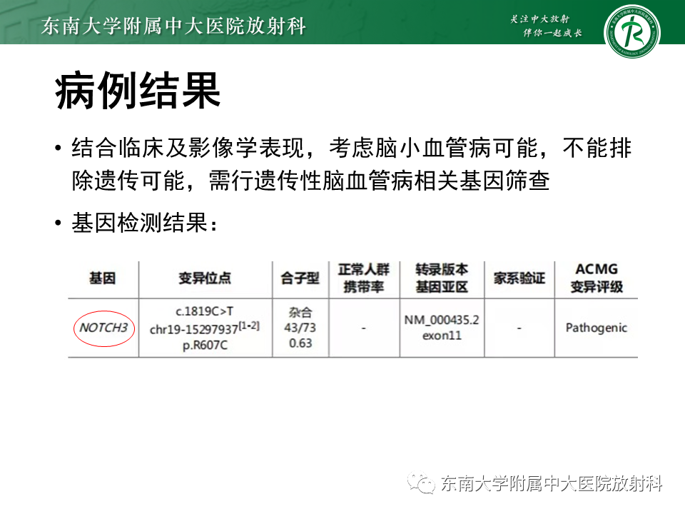 【PPT】伴有皮质下梗死和白质脑病的常染色体显性遗传性脑动脉病(CADASIL)-3