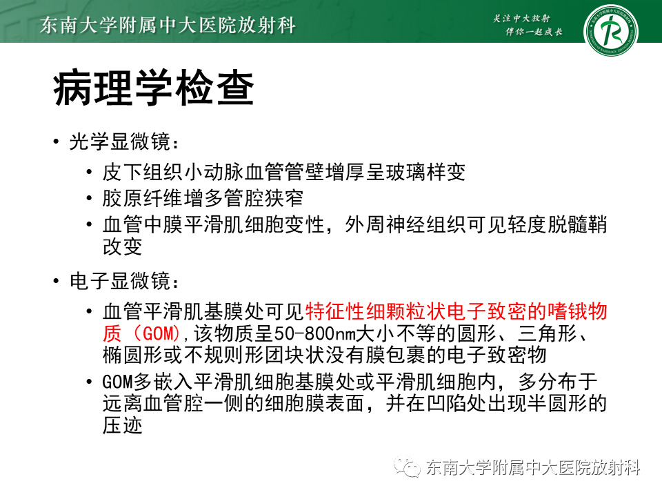 【PPT】伴有皮质下梗死和白质脑病的常染色体显性遗传性脑动脉病(CADASIL)-7