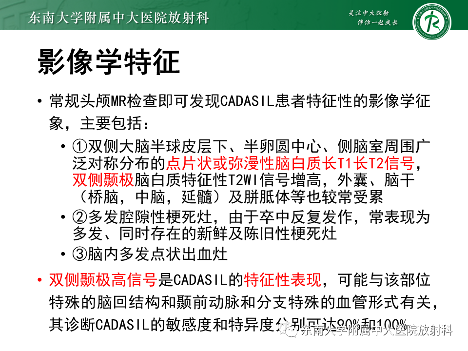 【PPT】伴有皮质下梗死和白质脑病的常染色体显性遗传性脑动脉病(CADASIL)-11