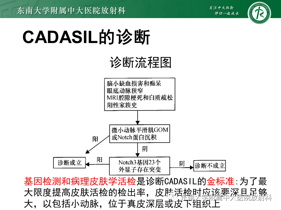 【PPT】伴有皮质下梗死和白质脑病的常染色体显性遗传性脑动脉病(CADASIL)-18