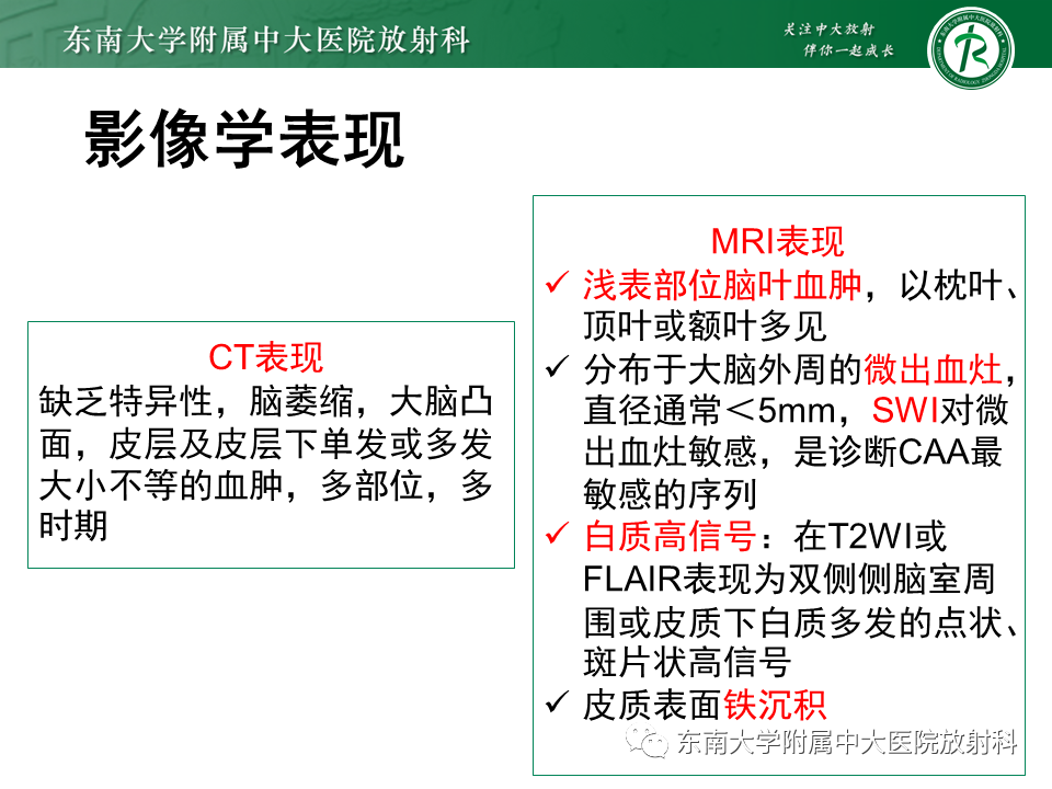 【PPT】伴有皮质下梗死和白质脑病的常染色体显性遗传性脑动脉病(CADASIL)-28