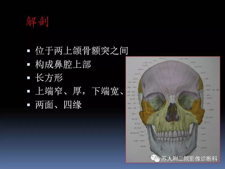 【PPT】鼻骨骨折影像诊断误区-3