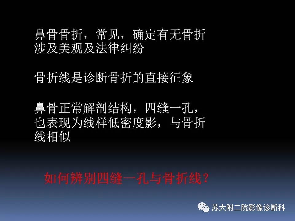 【PPT】鼻骨骨折影像诊断误区-2