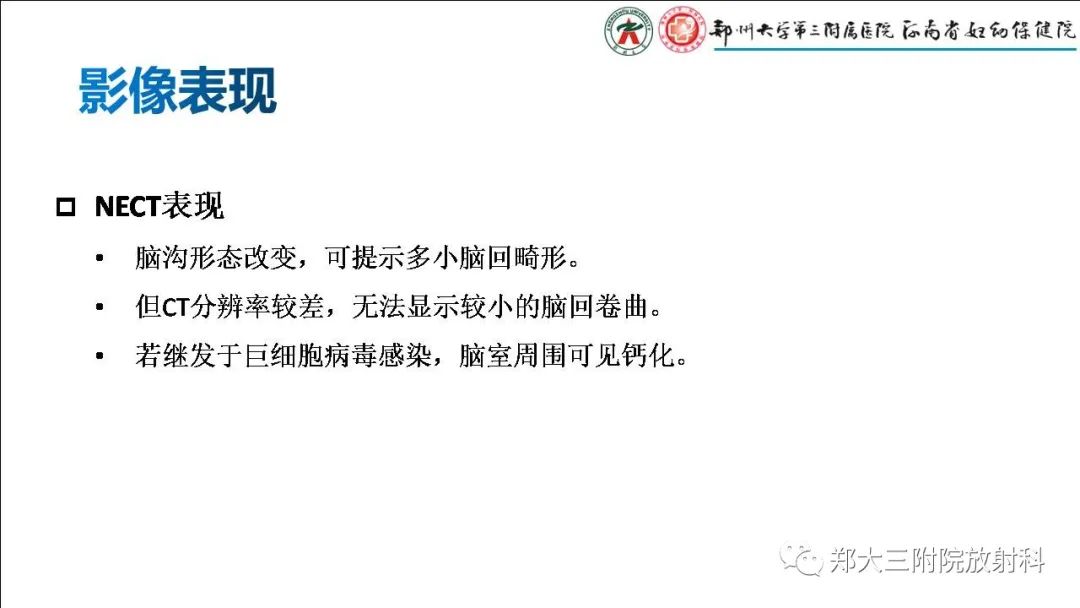 【PPT】多小脑回畸形的影像表现-4