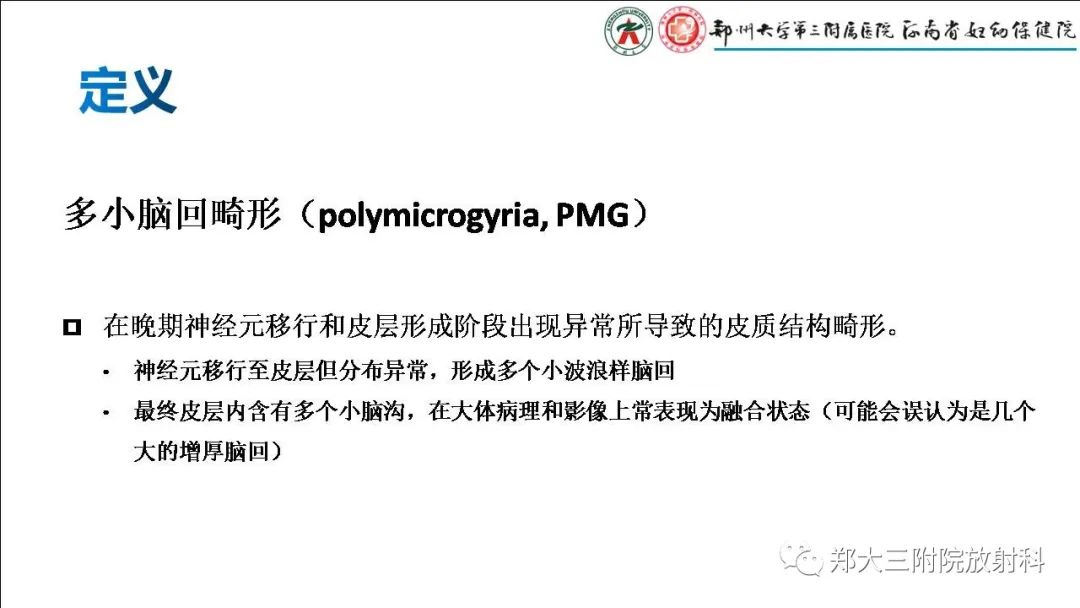 【PPT】多小脑回畸形的影像表现-2