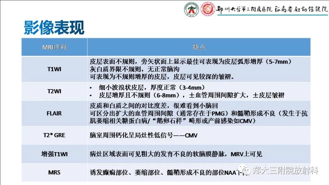 【PPT】多小脑回畸形的影像表现-5