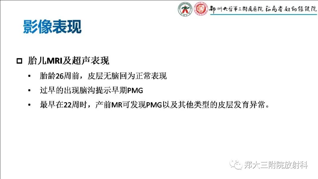 【PPT】多小脑回畸形的影像表现-6