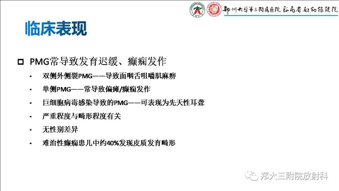 【PPT】多小脑回畸形的影像表现-11