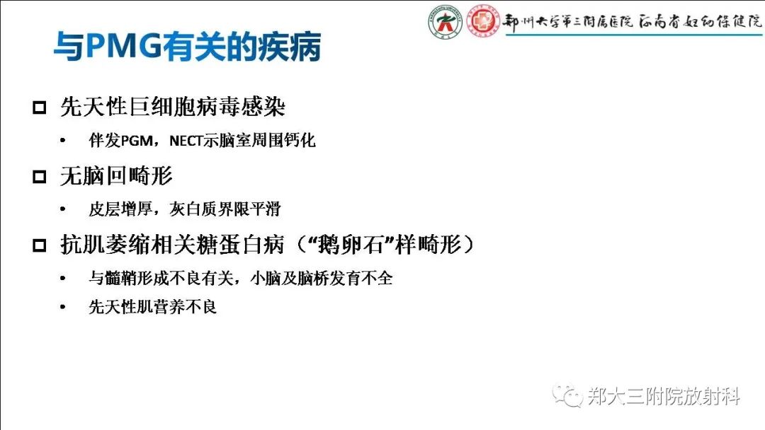 【PPT】多小脑回畸形的影像表现-14